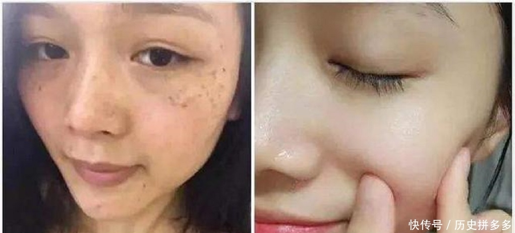 生姜果然是“祛斑高手”,坚持这样敷脸,7天见效半月恢复白皙!