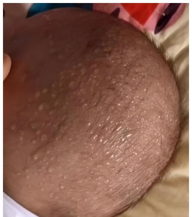 脾胃|4岁男孩身高已经126公分,医生:这个消食习惯非常好,家长多