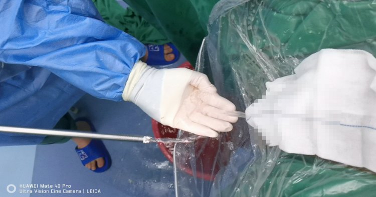 尿道|随治随走！快来认识下神奇的绿激光