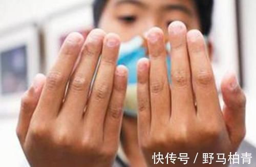 行为|孩子喜欢咬指甲,别认为是小事!这3个原因家长需了解,不要忽视