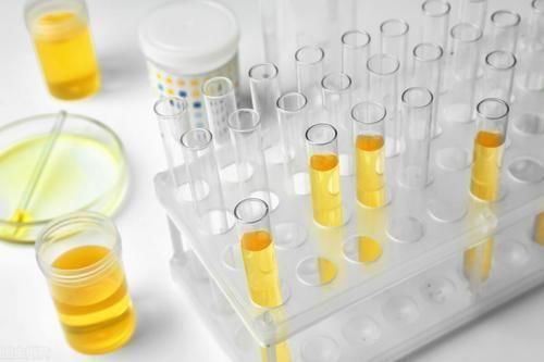 现象|出现“蛋白尿”一定是生病了吗？3类情况属于正常现象，不用担心
