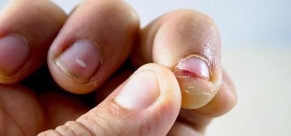 本能|若你经常咬指甲，与身体4种“本能”有关，但很多人不清楚！