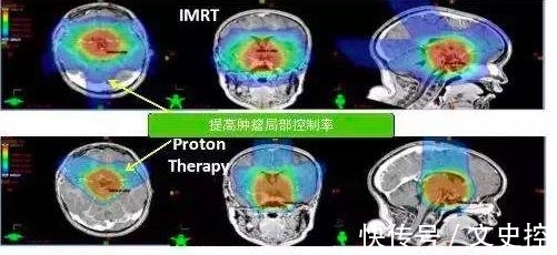 他把头伸进了粒子加速器,直接被接近光速的