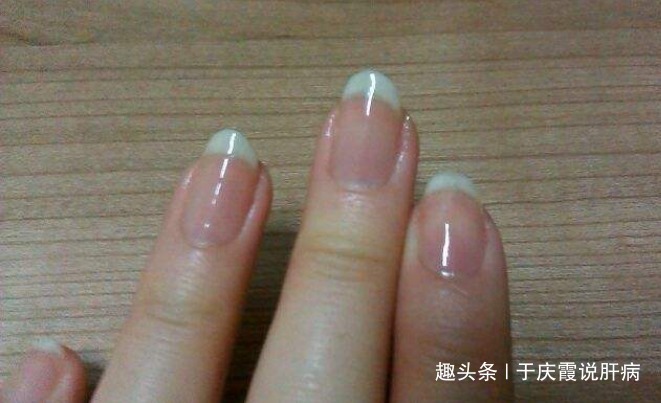 异常|肝不好的女人,早起会有3种异常,肝硬化顺势而起,肝癌悄然而至