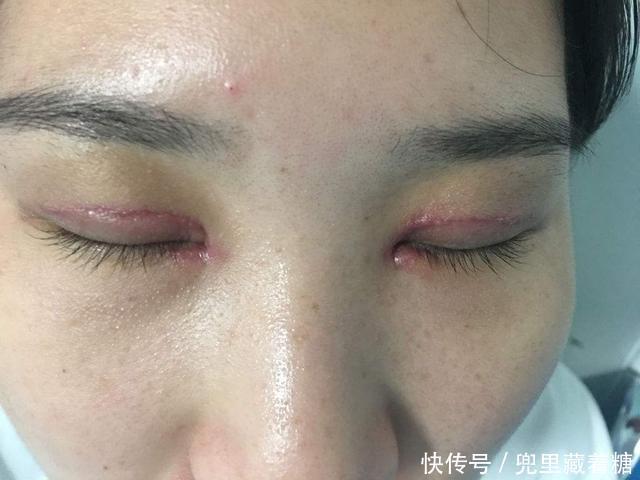 曾经那些割了双眼皮的美女,10年后会变啥样,看完还敢割吗?