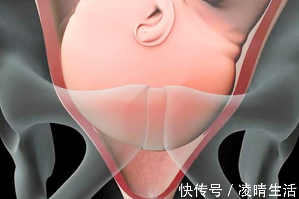 小结|“胎儿头大不能顺产”产前双顶径多大,孕妈才能顺利自然分娩