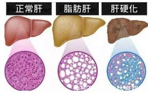 雌性激素|肝功能下降,身体3个部位或会变红,提示你要好好养肝护肝