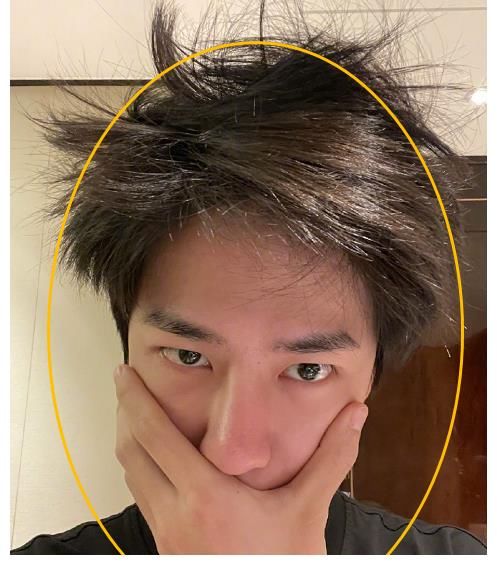 张艺兴|张艺兴综艺早起，素颜水肿状态过分真实，原来明星也是会水肿的