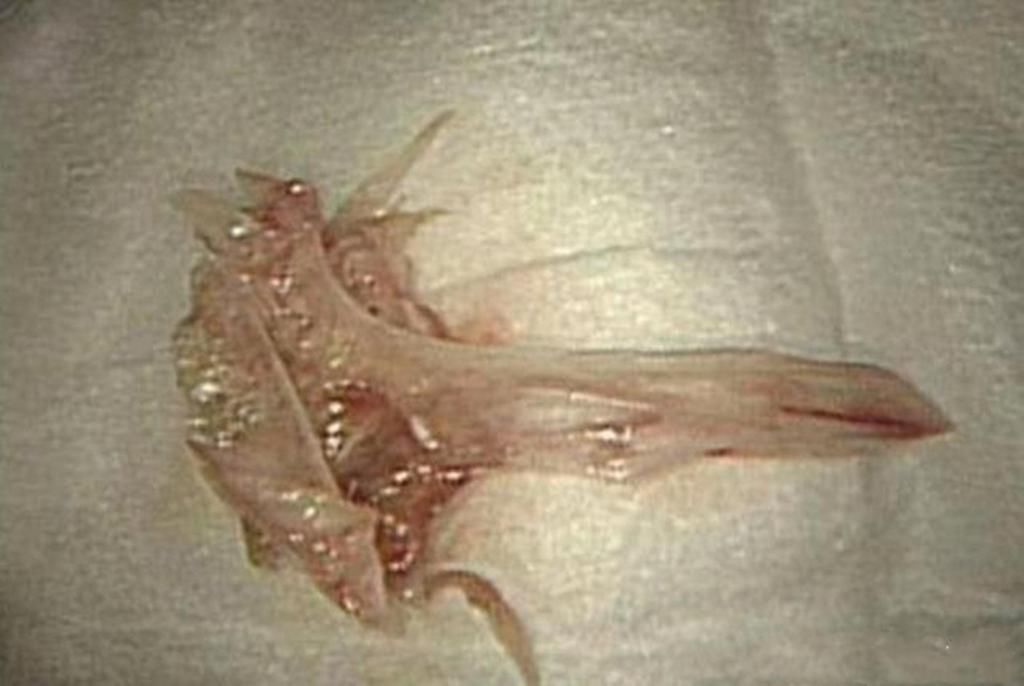 软糖|父母眼中的“健康零食”,制作环境堪比垃圾场,父母至今蒙在鼓里