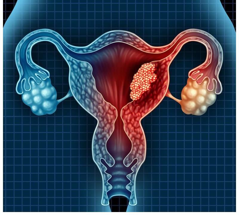 卵巢|更年期的女性身材容易发胖，专家：或与这三个原因有关，劝你趁早避开