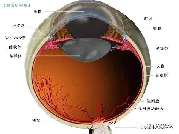 高度近视|眼睛出血，究竟可不可怕？