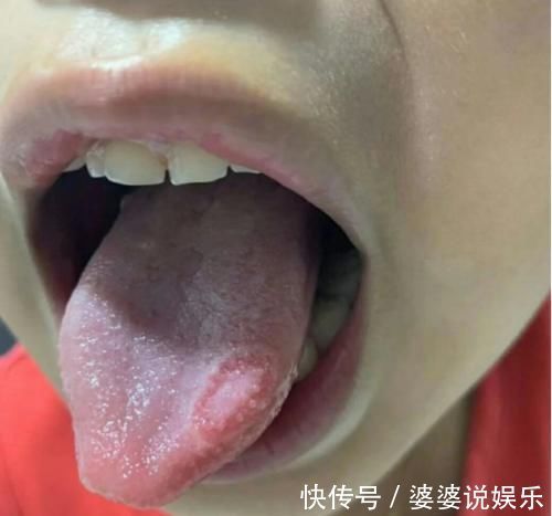 白萝卜汤|中医教你:小孩积食不要慌,3招轻松解决“小儿积食”、调好脾胃