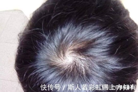 宝宝|宝贝头上的“头旋”个数代表啥？可能很多宝妈还不清楚