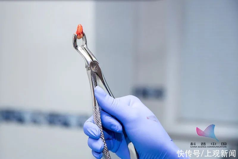 事项|5岁女童拔牙,大出血脑死亡!拔牙前,这些事项一定要知道