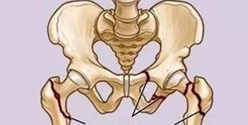 骨骼|世卫组织呼吁停止食用，比味精还伤骨骼，提醒父母：尽早撤下餐桌