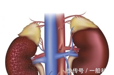 糖尿病|40%2型糖尿病人有肾病！记住7大危险因素，做好6件事预防！