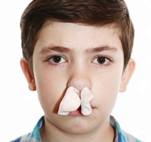 流鼻血后，要仰头、塞纸？别再错了，正确的处理方法记住这3点