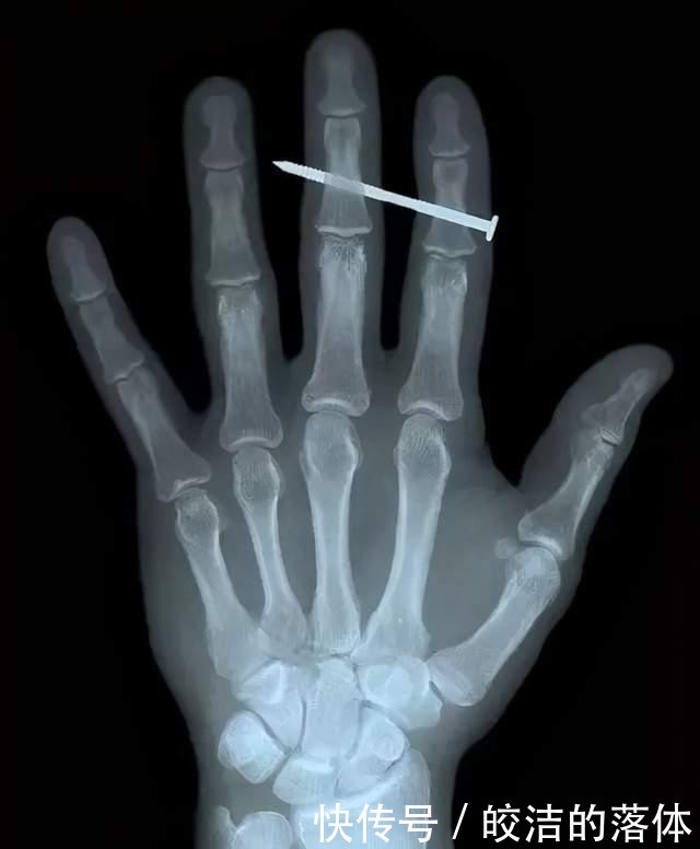 声波|做B超前涂的那层黏黏的、凉凉的液体是什么?做完要马上洗掉吗?