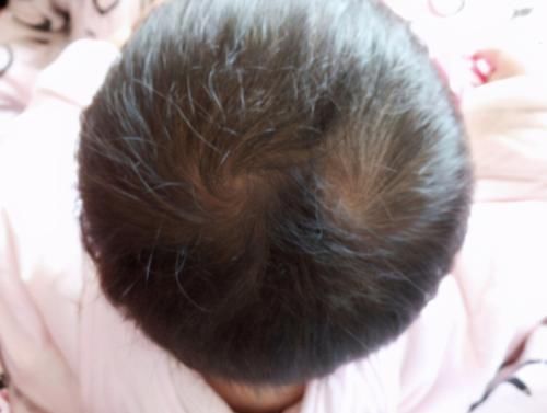 知晓|娃头上“一个旋”和“二个旋”有何区别?影响孩子性格,应知晓