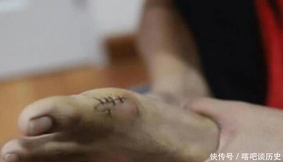 想到|泰国小哥因cos受伤,顺势cos路飞,网友:真是挚爱COS的小哥哥!