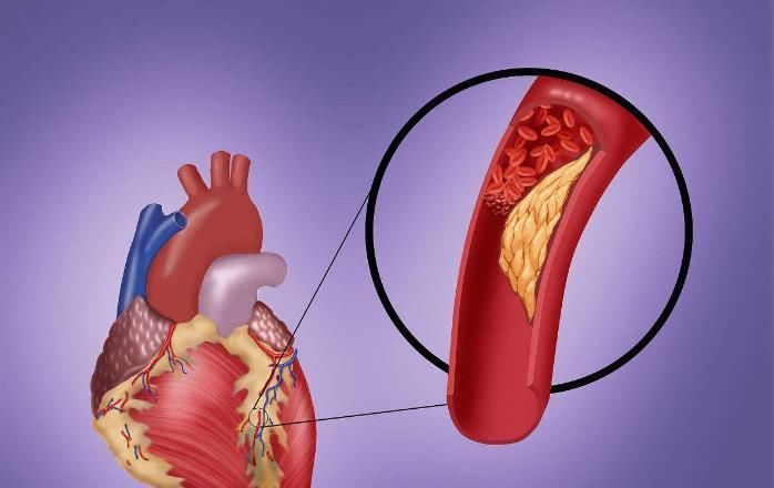 大米粥里加它们,赶走一身血栓,每天泡一杯,帮助活血化瘀清血管