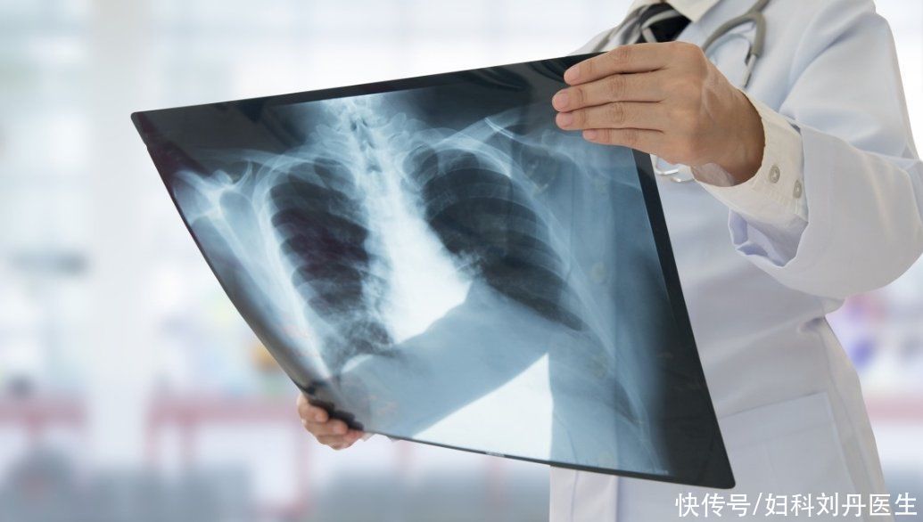 肝脏|癌细胞是如何“杀死”一个人的?它喜欢你做这3件事,别给它机会