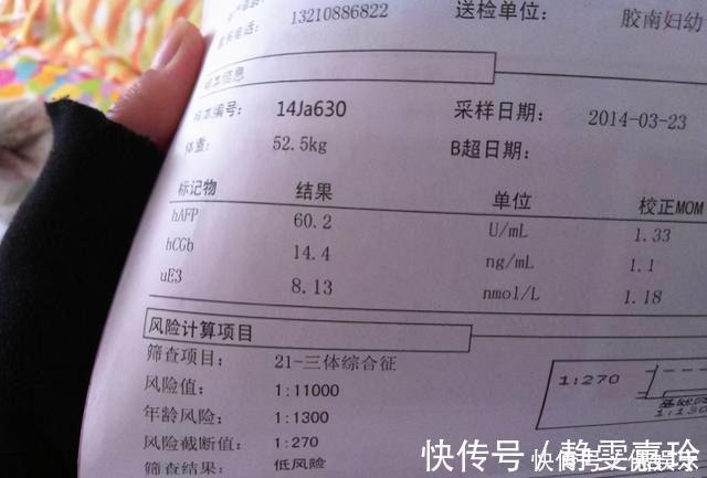 畸形|“胎儿畸形”危险期:过了这个月份,孕妈就可以把心放肚子里了