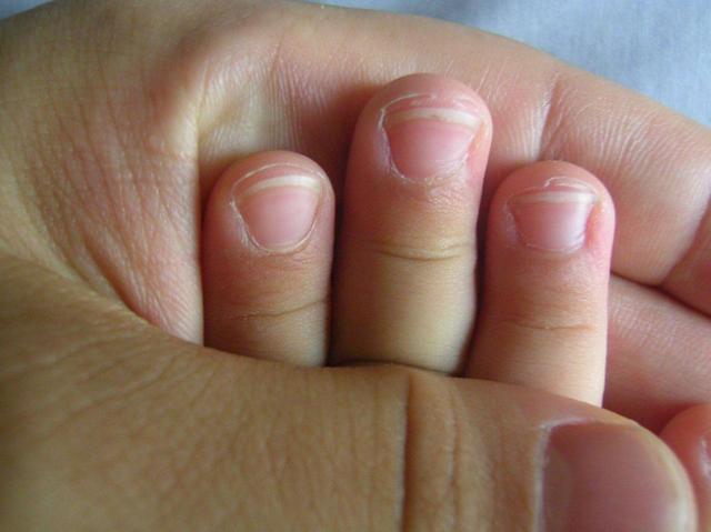 家娃|孩子聪明不聪明,从手上这些特征就能看出,快看看你家娃有吗