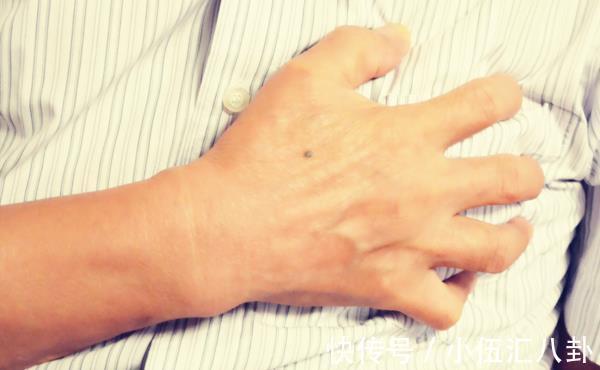 该病|高血压的人,只控制血压值就行了?别忘记检测心率,不妨看看