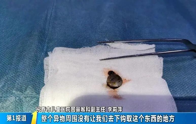 塞进|33个月宝宝电池塞进鼻子，鼻腔黏膜糜烂……