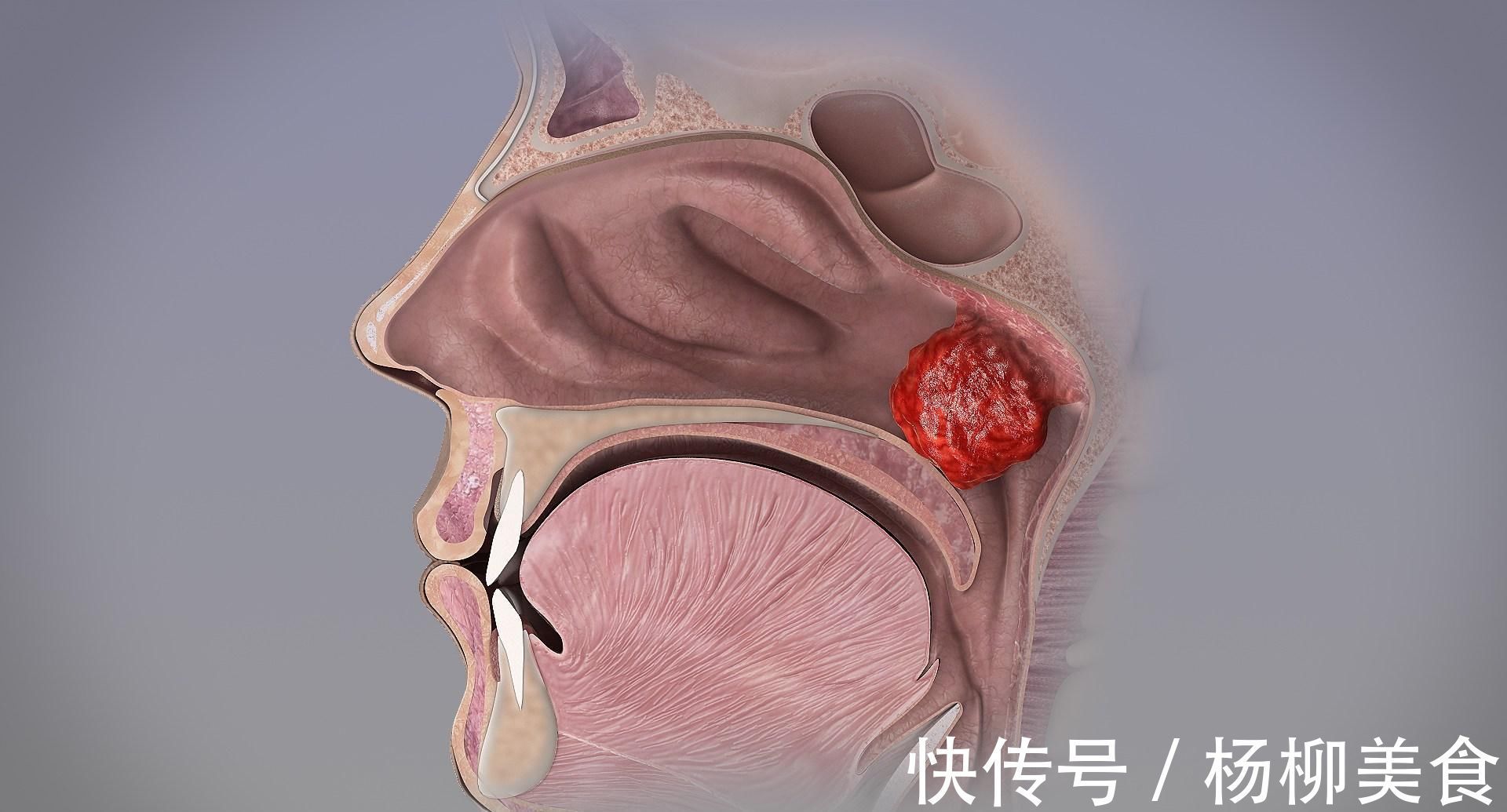 呼吸道|女儿被同学嘲笑像“青蛙”，妈妈没当一回事，朋友提醒才带去检查