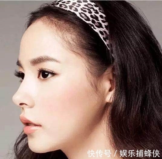 尖嘴猴|有哪些悄悄整过容的明星,现在教你一招如何识别整容脸网红脸!