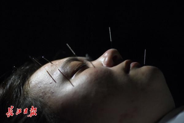 国医堂|火罐“拔出”中医热