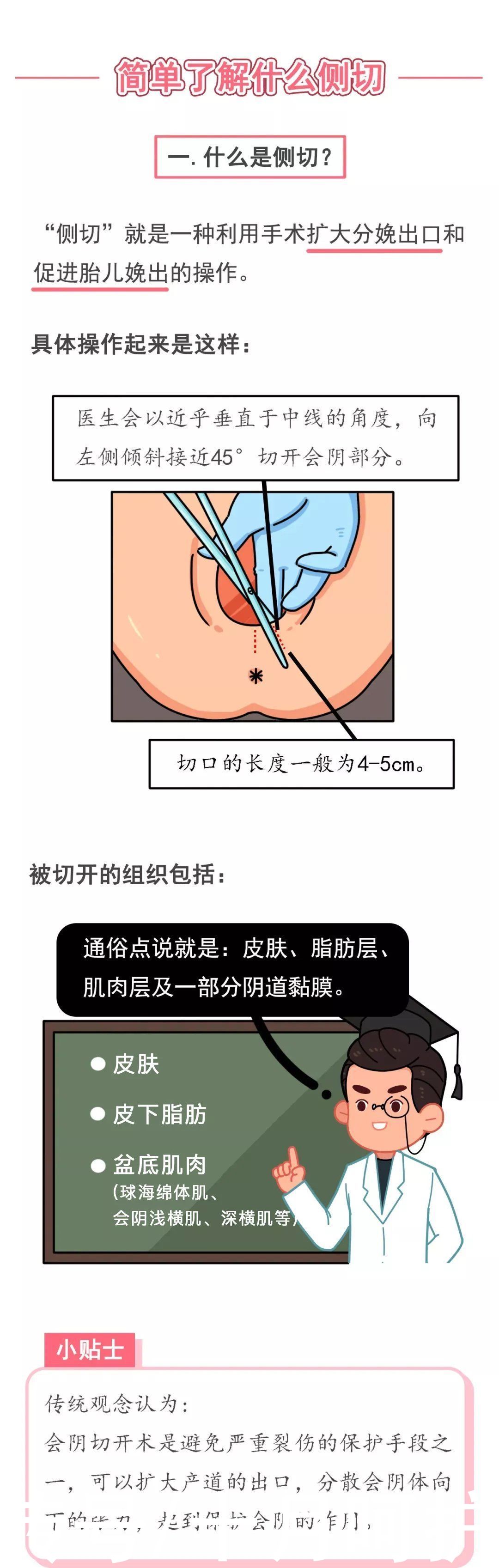 会阴体|顺产一定要侧切吗？这几种情况不需要