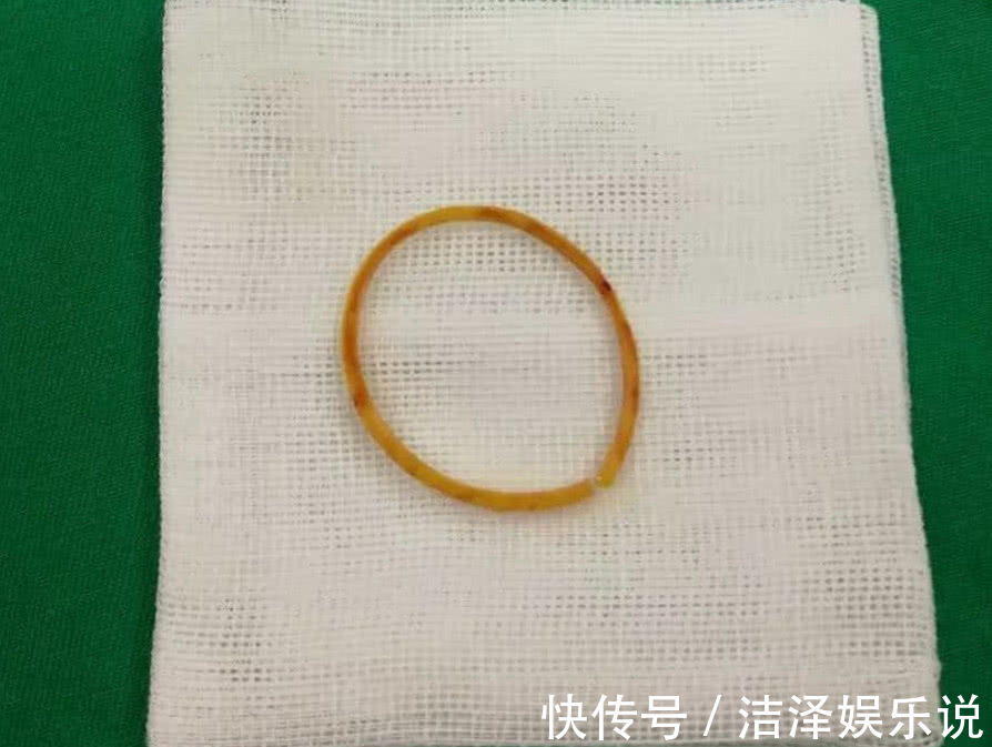 医生|4岁女孩得怪病,医生检查后,忍不住训斥父母心真大