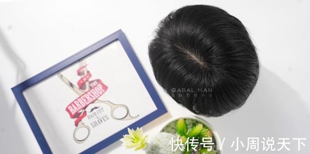 发型 地中海发型和戴假发,你更不能接受哪个!