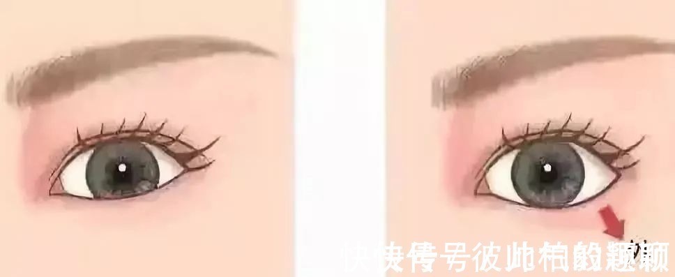 嘴角 这5个医美项目虽然很火,但很多医生不建议做!丨科普篇