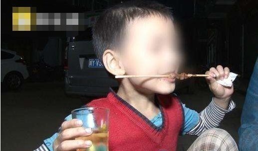 君君|9岁男童险成重度脑瘫医生这东西一口都别给孩子沾,危害太大