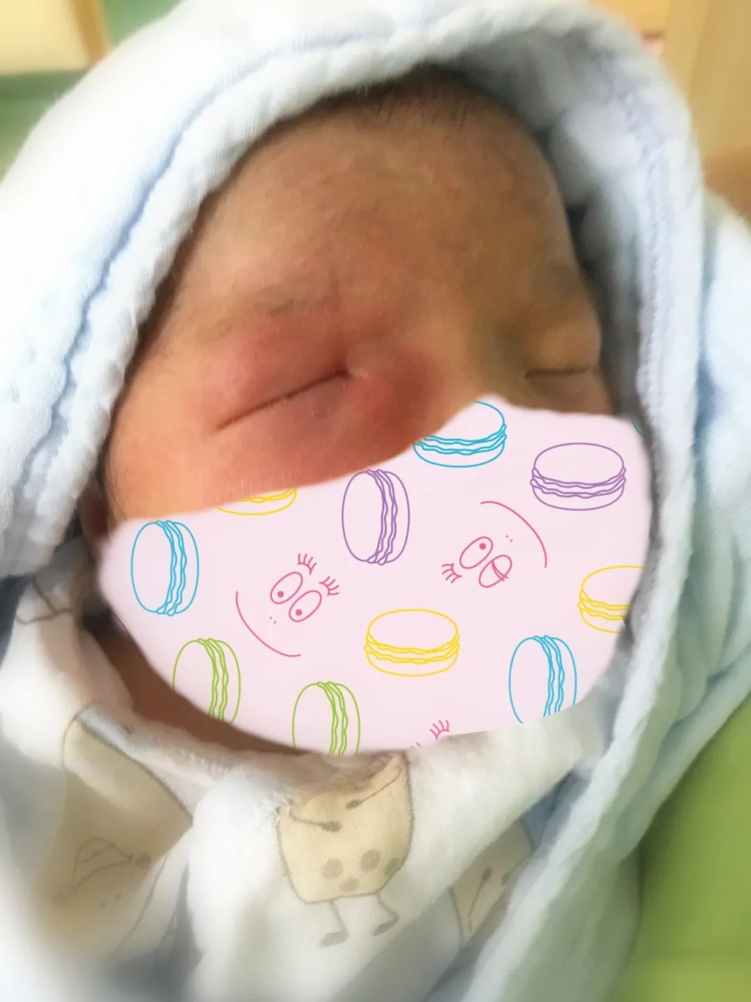 泪道|眼角抽出5管脓液,宝宝眼睛经常“泪汪汪”居然是病!拖延治疗严重的可能失明