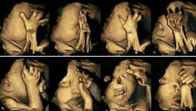 B超|产检做B超看见腹中胎儿不停做鬼脸，孕妇正开心，医生不能留