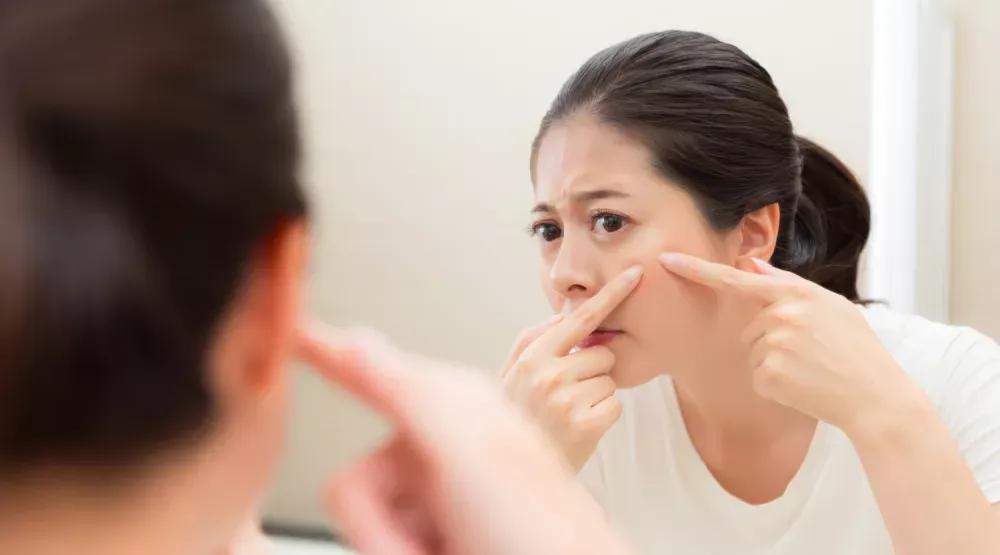 为什么你的痘痘永远反反复复消不下去?爆痘女孩必看