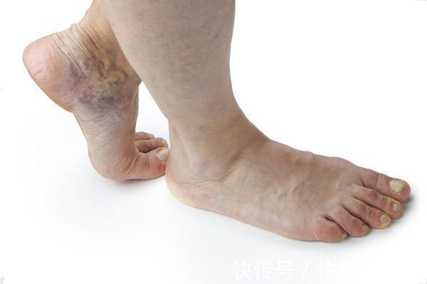 薏米|薏米如何吃?常吃薏米或能遇到6件“好事”,大家不妨看看!