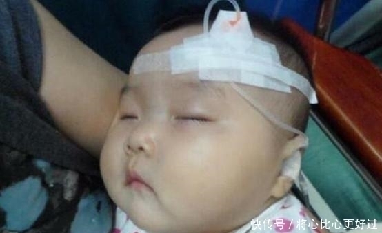零食|6岁半女童脾胃衰竭，2年不发育，医生：3种食物或是罪魁祸首