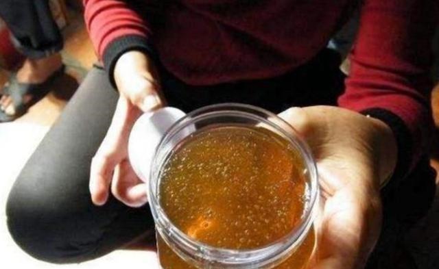 物件|5岁男孩吞入纽扣电池,妈妈急中生智的做法,让医生都点赞