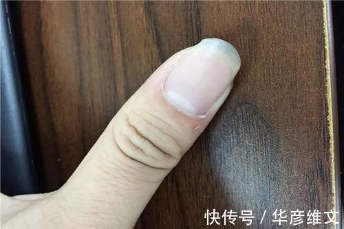 身体|当身体出现两个异常,是肺在向你求救,戒烟刻不容缓