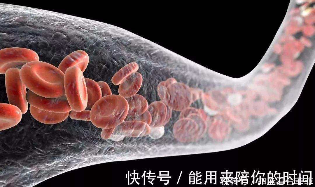 降血脂|心血管大夫:降血脂很简单,1种“零食”紧着吃,血管通畅人精神