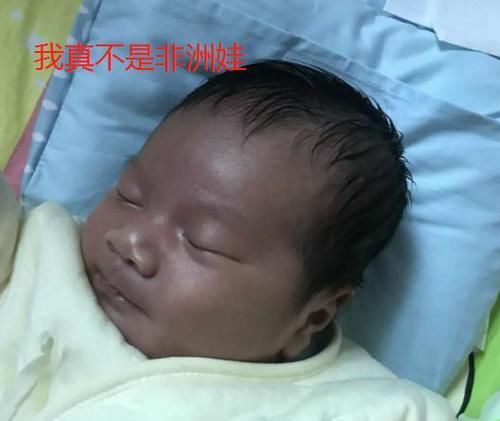 嫌弃|“黑脸宝宝”被亲妈嫌弃，护士却夸好看，2个月后高颜值逆袭