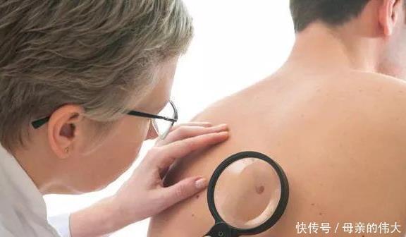 男女|肿瘤医生不论男女，当皮肤有这“反常”，癌症已大肆张扬
