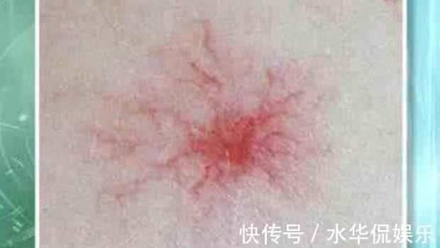 肝净如新|天然“解毒王”来了,没事吃两口,修复肝细胞,让你“肝净如新”