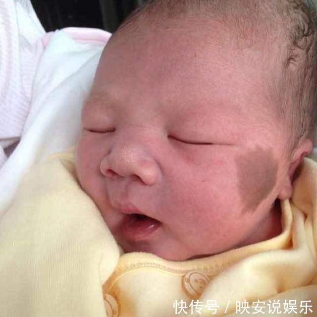 马虎|避免宝宝出生长胎记，怀孕期间一定要记住3件事，别马虎大意